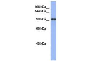 Image no. 1 for anti-La Ribonucleoprotein Domain Family, Member 1 (LARP1) (AA 107-156) antibody (ABIN6741640)