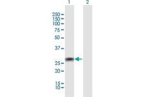 Image no. 2 for anti-Tripartite Motif Containing 72 (TRIM72) (AA 1-269) antibody (ABIN949979)