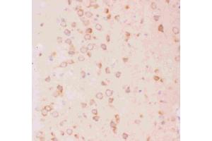 Image no. 6 for anti-Tuberous Sclerosis 2 (TSC2) (AA 1611-1807) antibody (ABIN3043498)