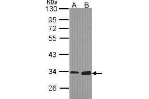 Image no. 4 for anti-Monoglyceride Lipase (MGLL) (Center) antibody (ABIN2855646)