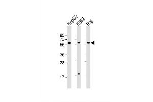 Image no. 2 for anti-Transforming Growth Factor, beta 1 (TGFB1) (AA 30-50) antibody (ABIN656282)
