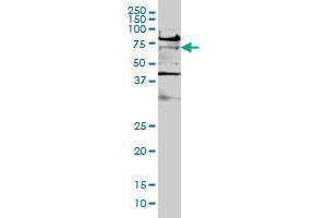 Image no. 1 for anti-Transcription Factor 7-Like 2 (T-Cell Specific, HMG-Box) (TCF7L2) (AA 1-455) antibody (ABIN563117)