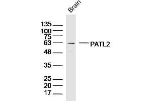 Image no. 1 for anti-Protein Associated with Topoisomerase II Homolog 2 (PATL2) (AA 301-400) antibody (ABIN5675743)