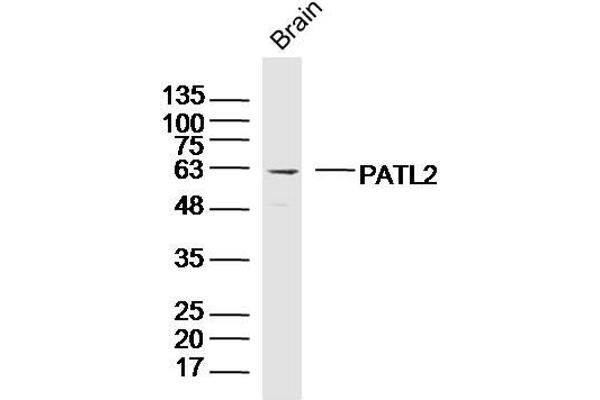 PATL2 antibody  (AA 301-400)