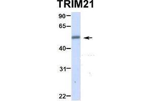 Image no. 2 for anti-Tripartite Motif Containing 21 (TRIM21) (N-Term) antibody (ABIN2778305)