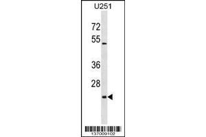 Image no. 1 for anti-UL16 Binding Protein 2 (ULBP2) (AA 88-116) antibody (ABIN1538674)