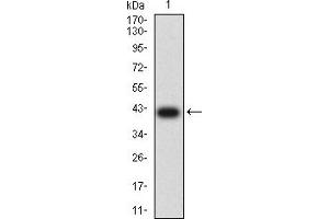 Image no. 2 for anti-Carcinoembryonic Antigen-Related Cell Adhesion Molecule 1 (Biliary Glycoprotein) (CEACAM1) (AA 65-201) antibody (ABIN5684132)