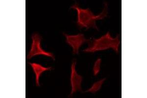 Image no. 2 for anti-Corticotropin Releasing Hormone Receptor 2 (CRHR2) antibody (ABIN6257813)