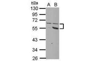 Image no. 1 for anti-Plexin Domain Containing 2 (PLXDC2) (AA 1-218) antibody (ABIN1500293)