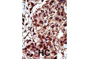 Image no. 2 for anti-Diacylglycerol Kinase, iota (DGKI) (AA 890-920), (C-Term) antibody (ABIN392719)