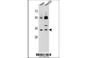 Image no. 1 for anti-Aldo-Keto Reductase Family 1, Member C3 (3-alpha Hydroxysteroid Dehydrogenase, Type II) (AKR1C3) (AA 107-135) antibody (ABIN655603)