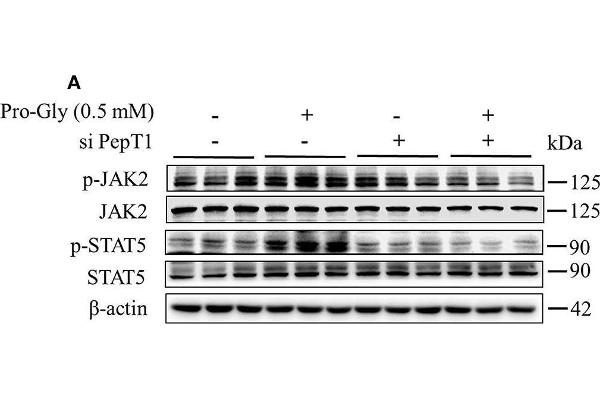 JAK2 Antikörper  (pTyr1007, pTyr1008)