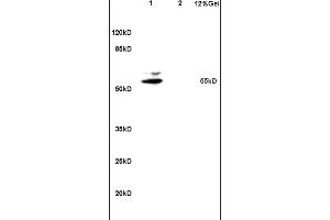 MATN1 antibody  (AA 301-400)