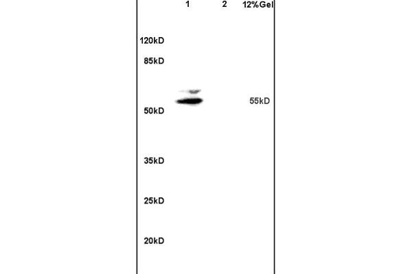 MATN1 antibody  (AA 301-400)