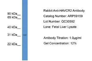 Image no. 2 for anti-Hepatitis A Virus Cellular Receptor 2 (TIM 3) (C-Term) antibody (ABIN2787957)