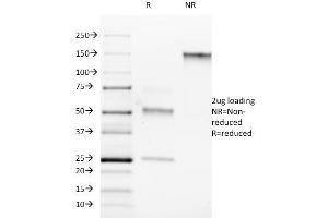 Image no. 1 for anti-RAR-Related Orphan Receptor C (RORC) antibody (ABIN6940534)