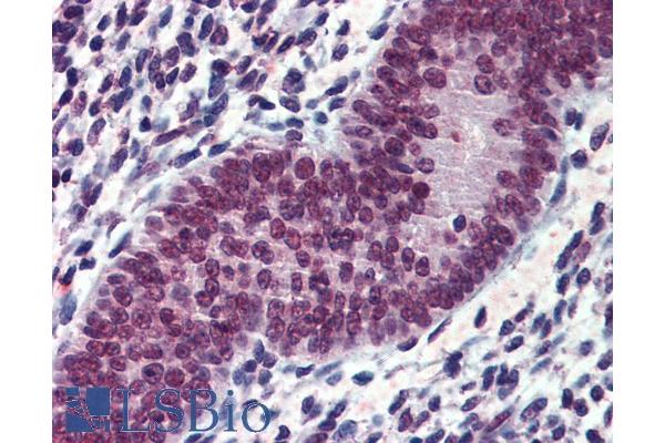 anti-Ewing Sarcoma Breakpoint Region 1 (EWSR1) (Internal Region) antibody
