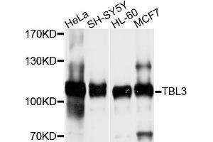 Image no. 2 for anti-Transducin (Beta)-Like 3 (TBL3) antibody (ABIN4905375)