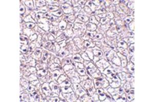 Image no. 1 for anti-Cytokine Receptor-Like Factor 2 (CRLF2) (Middle Region) antibody (ABIN318884)