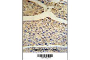 Immunohistochemistry (IHC) image for anti-Complement Factor B (CFB) antibody (ABIN2158221)
