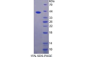 Image no. 1 for Resistin (RETN) (AA 19-109) protein (GST tag,S tag,His tag) (ABIN6236698)