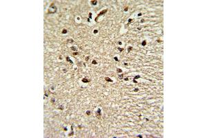 Image no. 3 for anti-Paired Box 4 (PAX4) antibody (ABIN3002750)