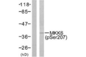 Image no. 1 for anti-Mitogen-Activated Protein Kinase Kinase 6 (MAP2K6) (pSer207) antibody (ABIN318071)