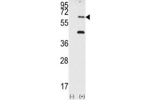 Image no. 4 for anti-Eukaryotic Translation Initiation Factor 2-alpha Kinase 2 (EIF2AK2) (AA 11-42) antibody (ABIN3030884)