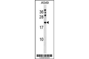 Image no. 1 for anti-M-Phase phosphoprotein 6 (MPHOSPH6) (N-Term) antibody (ABIN2446035)