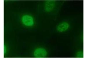 Image no. 2 for anti-Heterogeneous Nuclear Ribonucleoprotein A2/B1 (HNRNPA2B1) antibody (ABIN1449240)