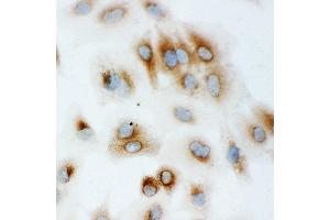 Image no. 2 for anti-Heat Shock 70kDa Protein 1A (HSPA1A) (AA 577-596), (C-Term) antibody (ABIN3044190)