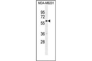 Image no. 1 for anti-Guanine Nucleotide Binding Protein-Like 3 (Nucleolar)-Like (GNL3L) (AA 102-130), (N-Term) antibody (ABIN952568)
