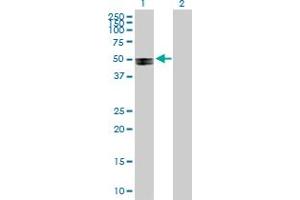 Image no. 1 for anti-AarF Domain Containing Kinase 4 (ADCK4) (AA 1-503) antibody (ABIN529140)