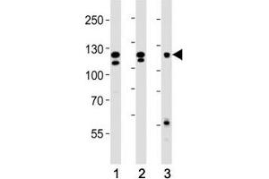 Image no. 5 for anti-Fibroblast Growth Factor Receptor 2 (FGFR2) (AA 7-37) antibody (ABIN3030951)