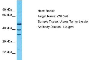 ZNF528 抗体  (Middle Region)