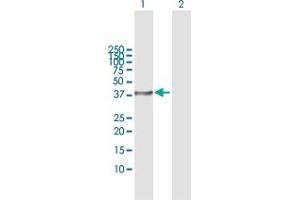 Image no. 2 for anti-serine/threonine Kinase 19 (STK19) (AA 1-364) antibody (ABIN522324)