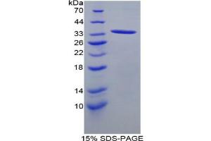 Image no. 1 for Angiopoietin-Like 1 (ANGPTL1) protein (ABIN3008281)