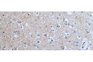Immunohistochemistry of paraffin-embedded Human brain tissue using BRSK2 Polyclonal Antibody at dilution of 1:70(x200)