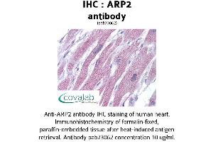 Image no. 2 for anti-Actin Related Protein 2/3 Complex, Subunit 1B, 41kDa (ARPC1B) (AA 40-311) antibody (ABIN1731960)