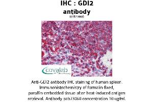 Image no. 2 for anti-GDP Dissociation Inhibitor 2 (GDI2) (AA 1-197) antibody (ABIN1734666)