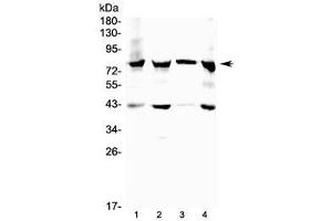 Image no. 4 for anti-Hydroxysteroid (17-Beta) Dehydrogenase 4 (HSD17B4) (C-Term) antibody (ABIN3031274)