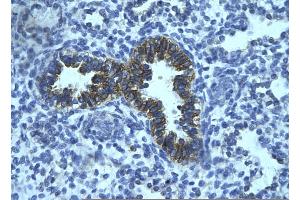 Image no. 1 for anti-PHD Finger Protein 16 (PHF16) (Middle Region) antibody (ABIN2775729)