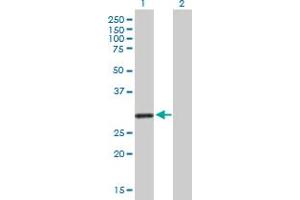 Image no. 1 for anti-Potassium Channel Regulator (KCNRG) (AA 1-272) antibody (ABIN531535)