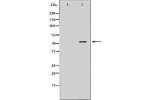 Image no. 1 for anti-Nicotinic Acetylcholine Receptor beta (CHRNB1) (N-Term) antibody (ABIN6260825)