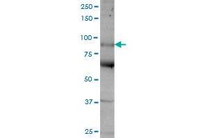 Image no. 1 for anti-Antigen P97 (Melanoma Associated) Identified By Monoclonal Antibodies 133.2 and 96.5 (MFI2) (AA 1-302) antibody (ABIN517892)
