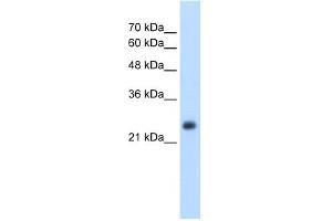 Image no. 1 for anti-Nicotinamide N-Methyltransferase (NNMT) (N-Term) antibody (ABIN2775335)