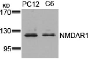 Image no. 1 for anti-NMDA Receptor 1 (NMDA R1) (AA 894-898) antibody (ABIN319311)