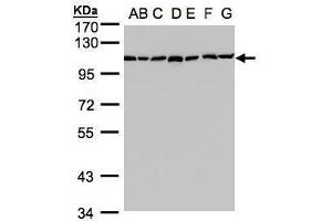 Image no. 2 for anti-Glucosidase, Alpha, Neutral AB (GANAB) (N-Term) antibody (ABIN2855336)