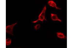 Image no. 3 for anti-Tumor Necrosis Factor Receptor Superfamily, Member 1B (TNFRSF1B) (C-Term) antibody (ABIN6256994)