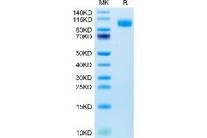 EGFR Protein (His-Avi Tag)